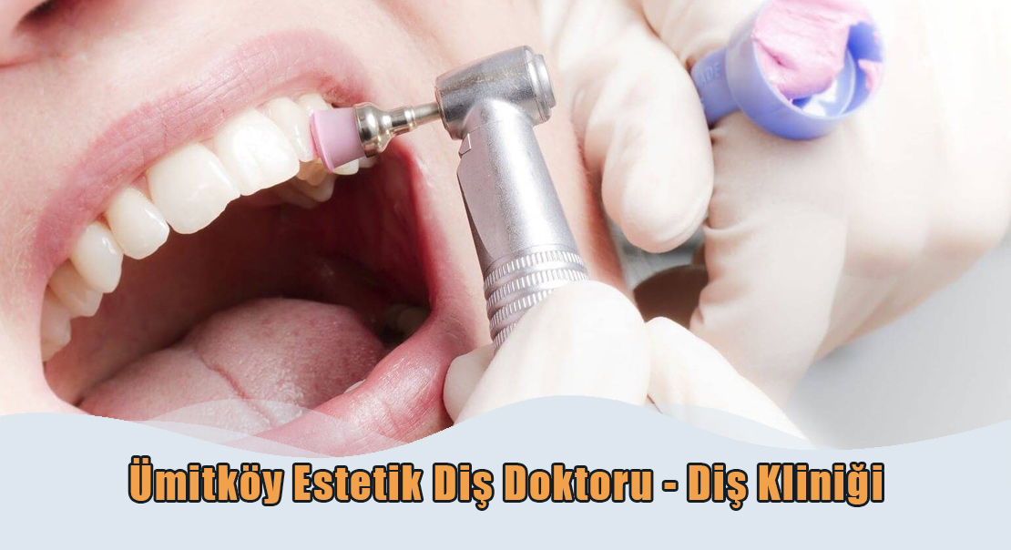 Ümitköy Estetik Diş Kliniği