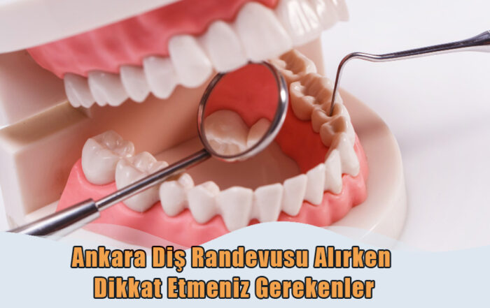 Ankara Diş Randevusu