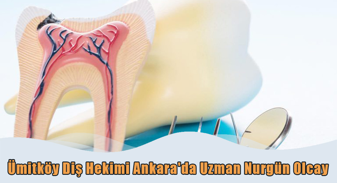 Ümitköy Diş Hekimi Ankara'da