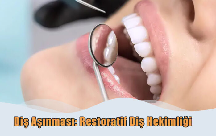 Diş Aşınması: