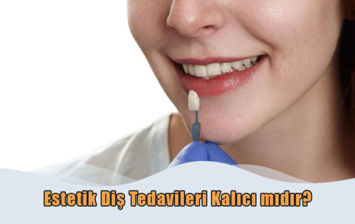 Estetik Diş Tedavileri Kalıcı mıdır?
