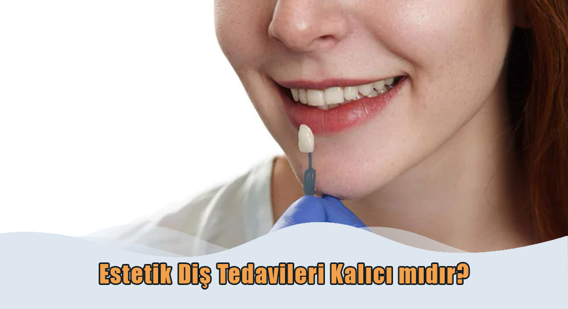 Estetik Diş Tedavileri Kalıcı mıdır?