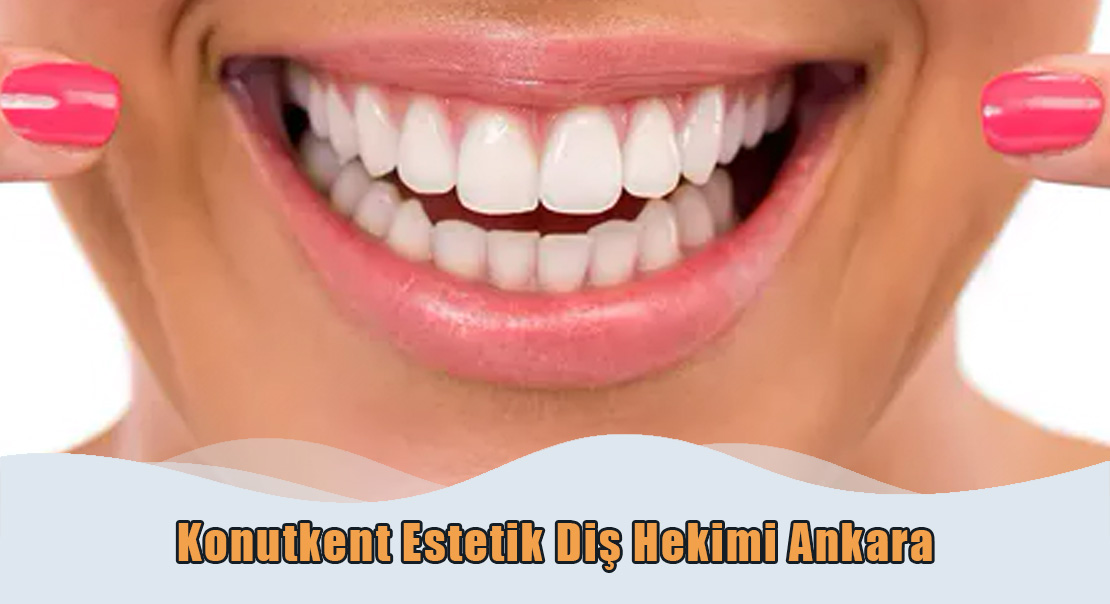 Konutkent Estetik Dis Hekimi Konutkent Estetik Diş Hekimi Ankara