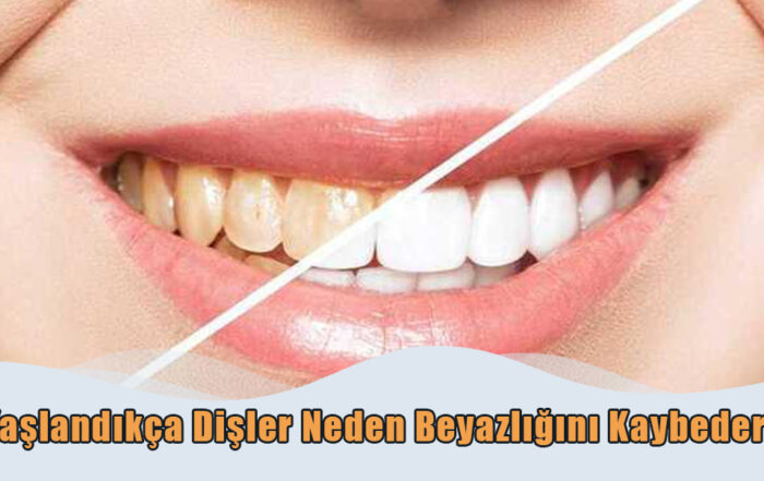 Yaşlandıkça Dişler Neden Beyazlığını
