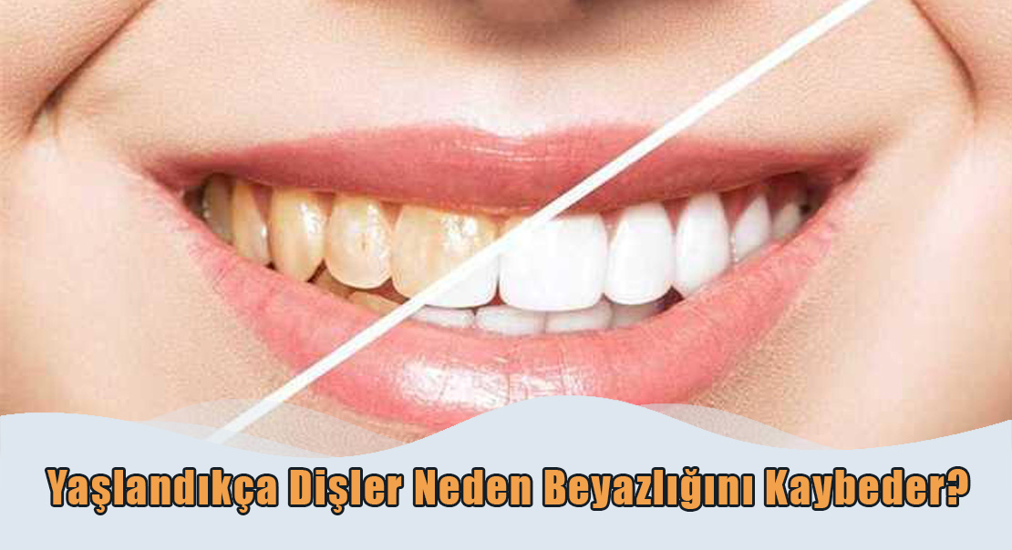 Yaşlandıkça Dişler Neden Beyazlığını
