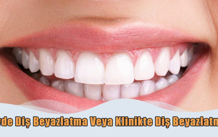 Evde Diş Beyazlatma