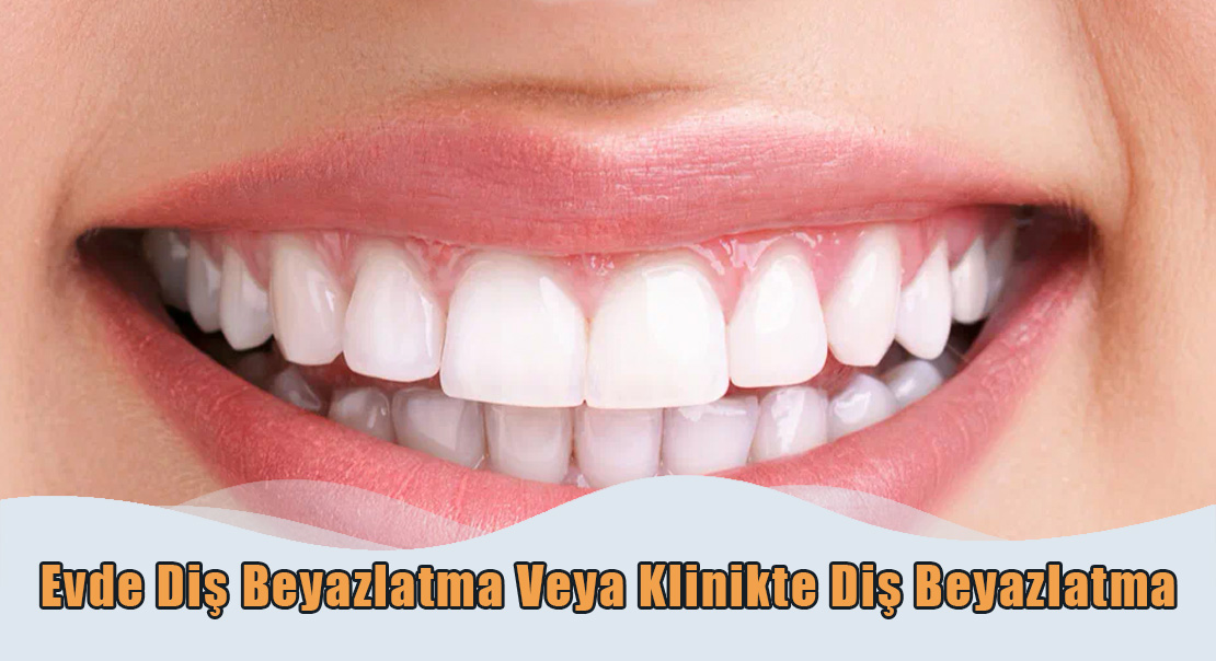 Evde Diş Beyazlatma
