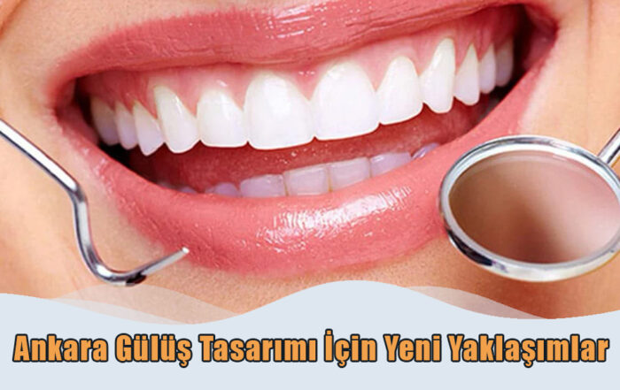 Gülüş Tasarımı İçin Yeni Yaklaşımlar