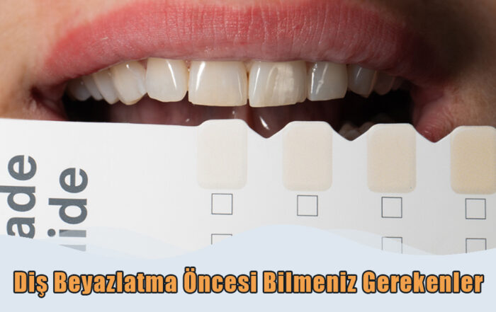 Diş Beyazlatma Öncesi