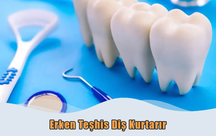 Erken Teşhis Diş Kurtarır