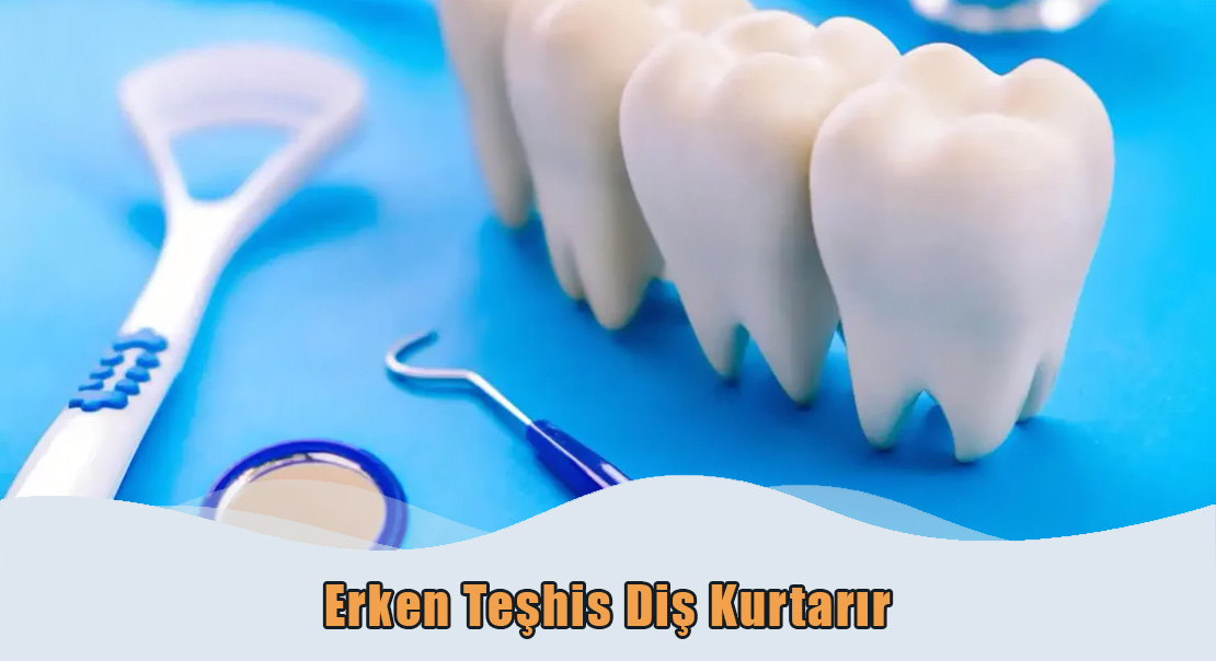 Erken Teşhis Diş Kurtarır