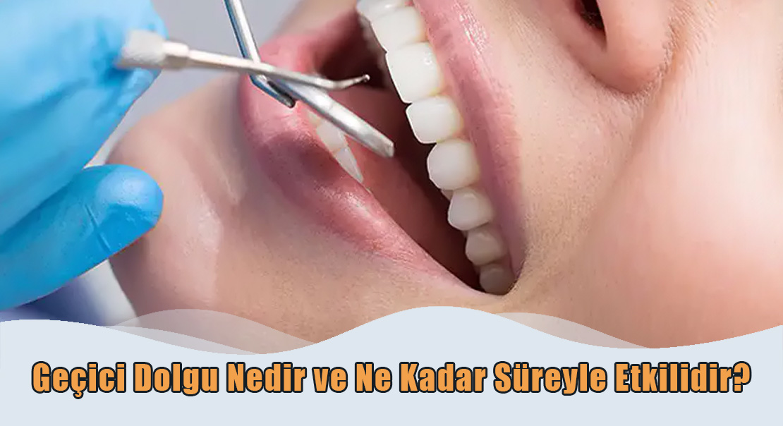 Geçici Dolgu Nedir?