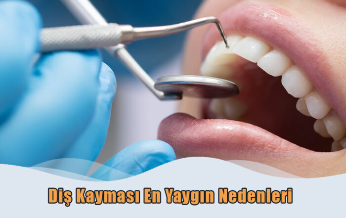Diş Kayması En Yaygın Nedenleri