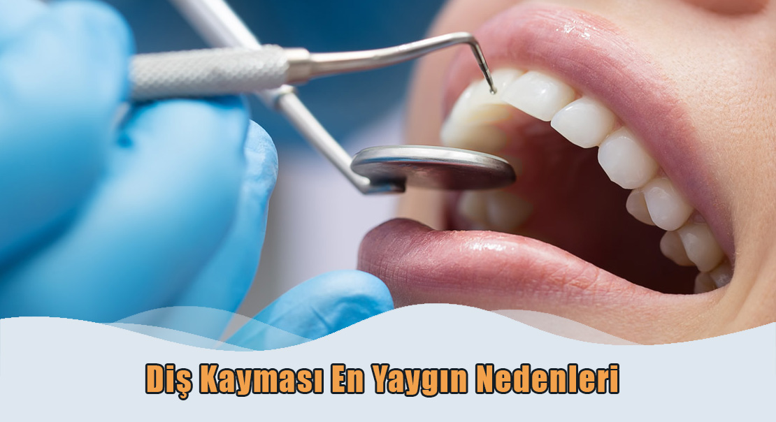 Diş Kayması En Yaygın Nedenleri