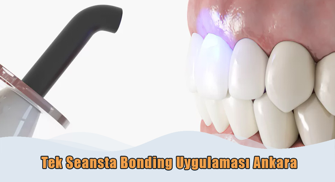 Tek Seansta Bonding Ankara