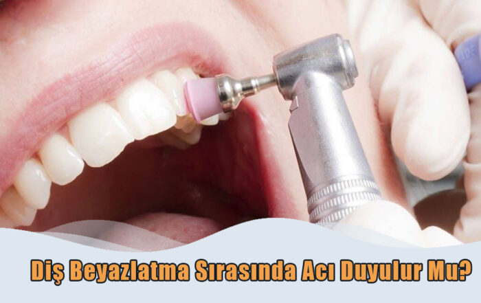 Diş Beyazlatma Sırasında Acı