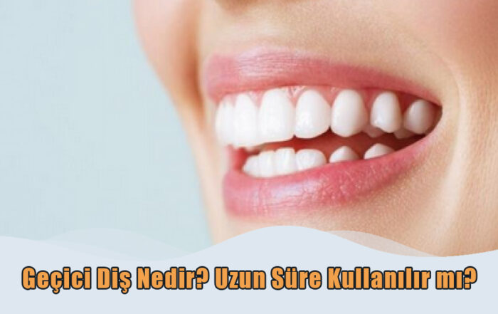 Geçici Diş Nedir?