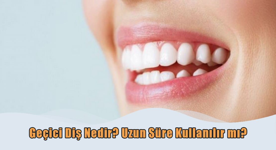 Geçici Diş Nedir?