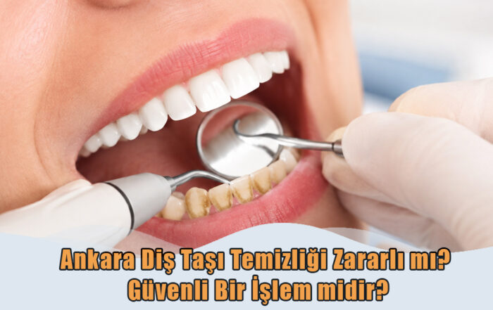 Ankara Diş Taşı Temizliği Zararlı mı?