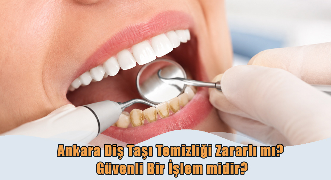 Ankara Diş Taşı Temizliği Zararlı mı?