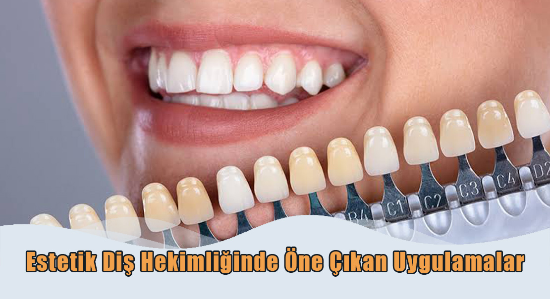 Estetik Diş Hekimliğinde