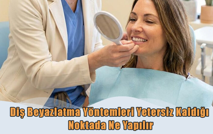 Diş Beyazlatma Yöntemleri