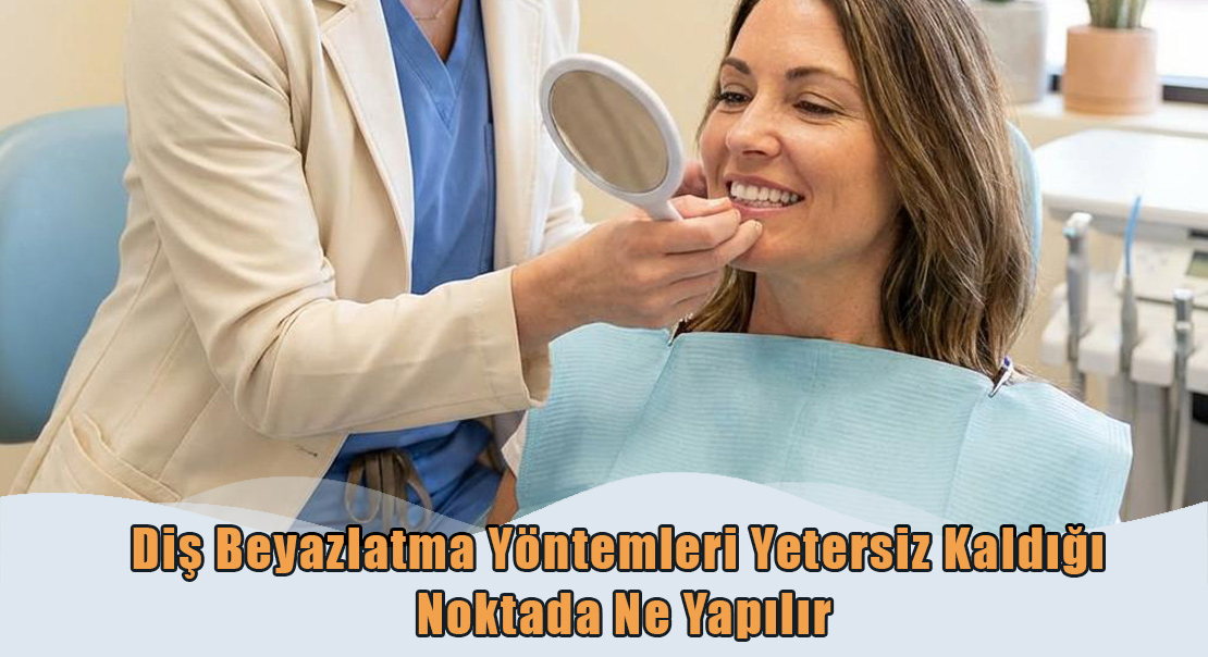 Diş Beyazlatma Yöntemleri