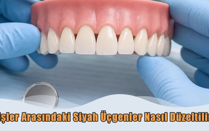 Dişler Arasındaki Siyah Üçgenler Dişler Arasındaki Siyah Üçgenler Nasıl Düzeltilir?